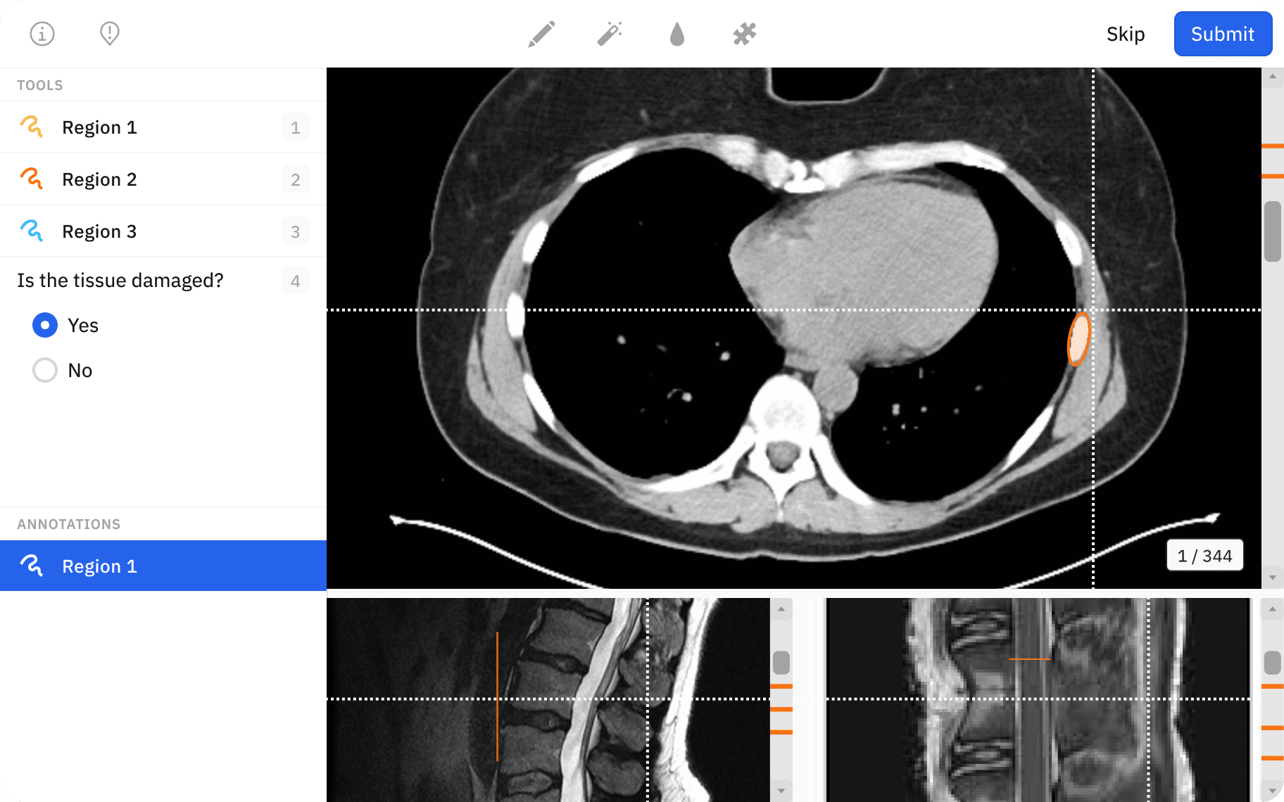 Label with surgical precision